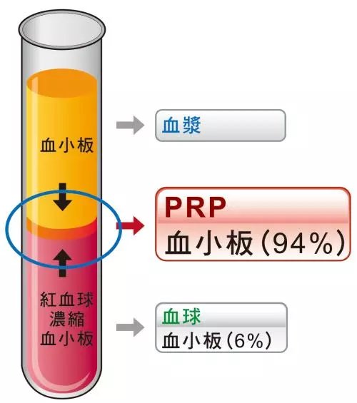 PRP技术培训（19年北京）PRP技术骨病疼痛临床应用讲习班
